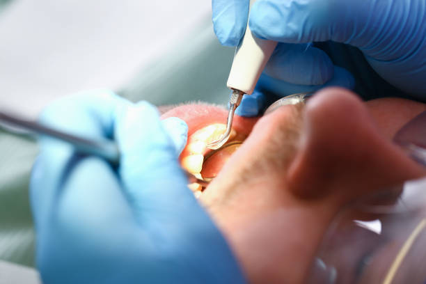 Best Emergency Denture Repair in Montclair State University, NJ