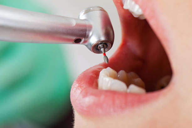 Best Emergency Cosmetic Dentistry (e.g., broken veneers) in Montclair State University, NJ